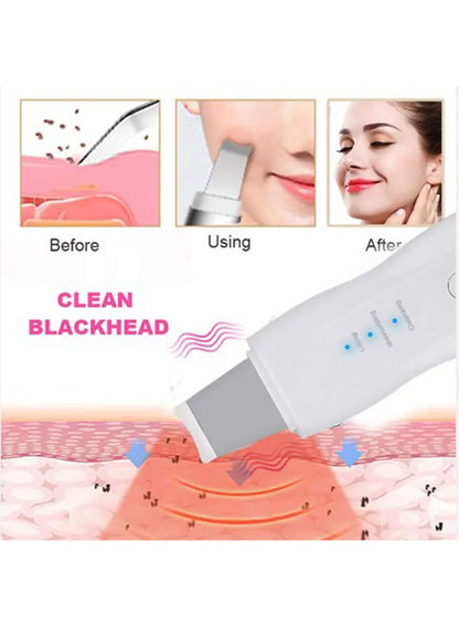 DANIM Face Blackhead Remover Cleaner Beauty Personal Care Facial Dead Skin Electric Boby Skin Care Tool Shake Clean Skin Scrubber DIY Face Ultrasonic Skin Scrubber DEEP CLEANSING